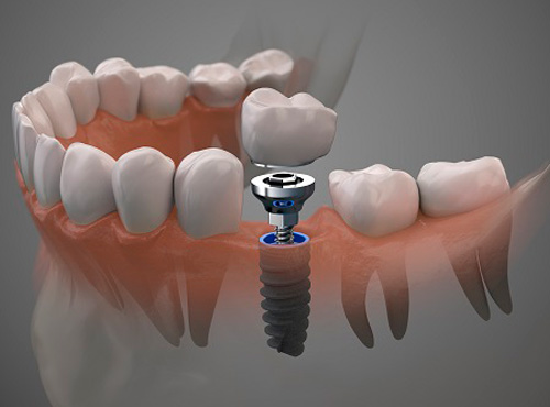 Clínica Odontológica -Cachoeirinha - SP